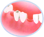 �C���v�����g�摜�P