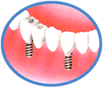 �C���v�����g�摜�R