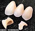 ハイブリッドセラミックス素材の歯の写真「東大阪インプラント/もりさわ歯科」