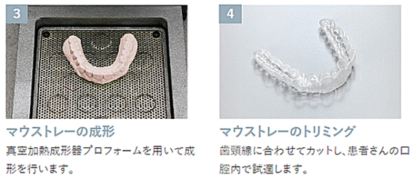 マウストレーの成形とマウストレーのトリミング