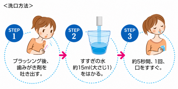 ホワイトニング後の歯磨はやわらかいブラシでやさしく、洗口は一回だけ行う説明の画像