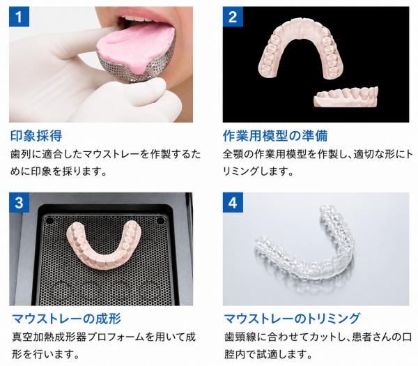 ホワイトニングマウスピース成作のステップ｜印象採得と作業用模型の準備後、マウストレー成形とトリミング