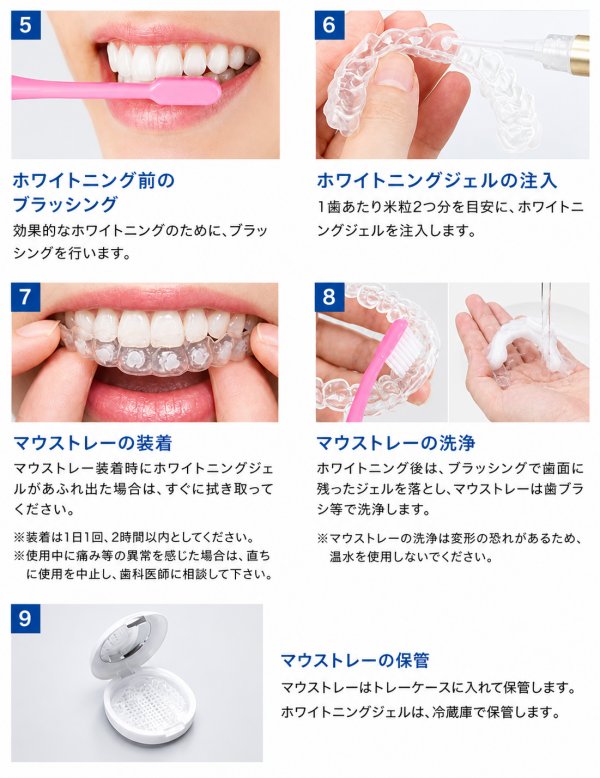 ブラッシングとホワイトニングジェルの注入。完了後はマウストレーはトレーケースで保管し、ホワイトニングジェルは冷蔵庫で保管