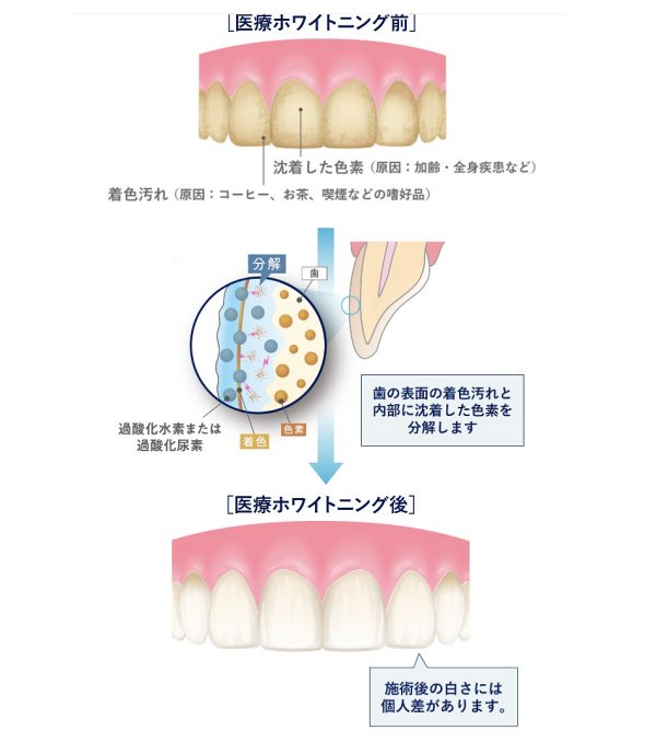 zCgoh̓zCgjOp邱ƂŖڗȂȂ܂B